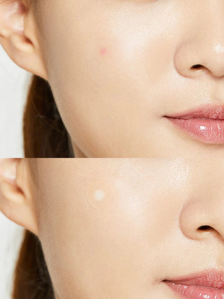 COSRX Acne Pimple Master-patch